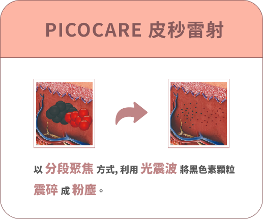 PICOCARE 皮秒雷射