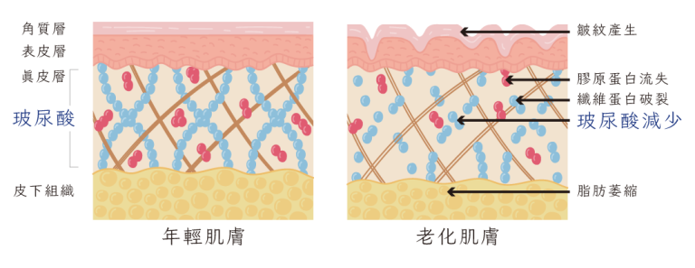 玻尿酸1 - 葛鎂診所